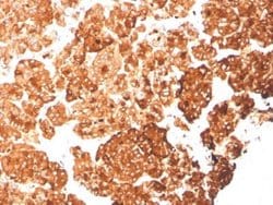 Cytokeratin 6a Antibody (rKRT6A/2100) - Azide and BSA Free, Novus Biologicals 100 &mu;g | Buy Online | Novus Biologicals | Fisher Scientific